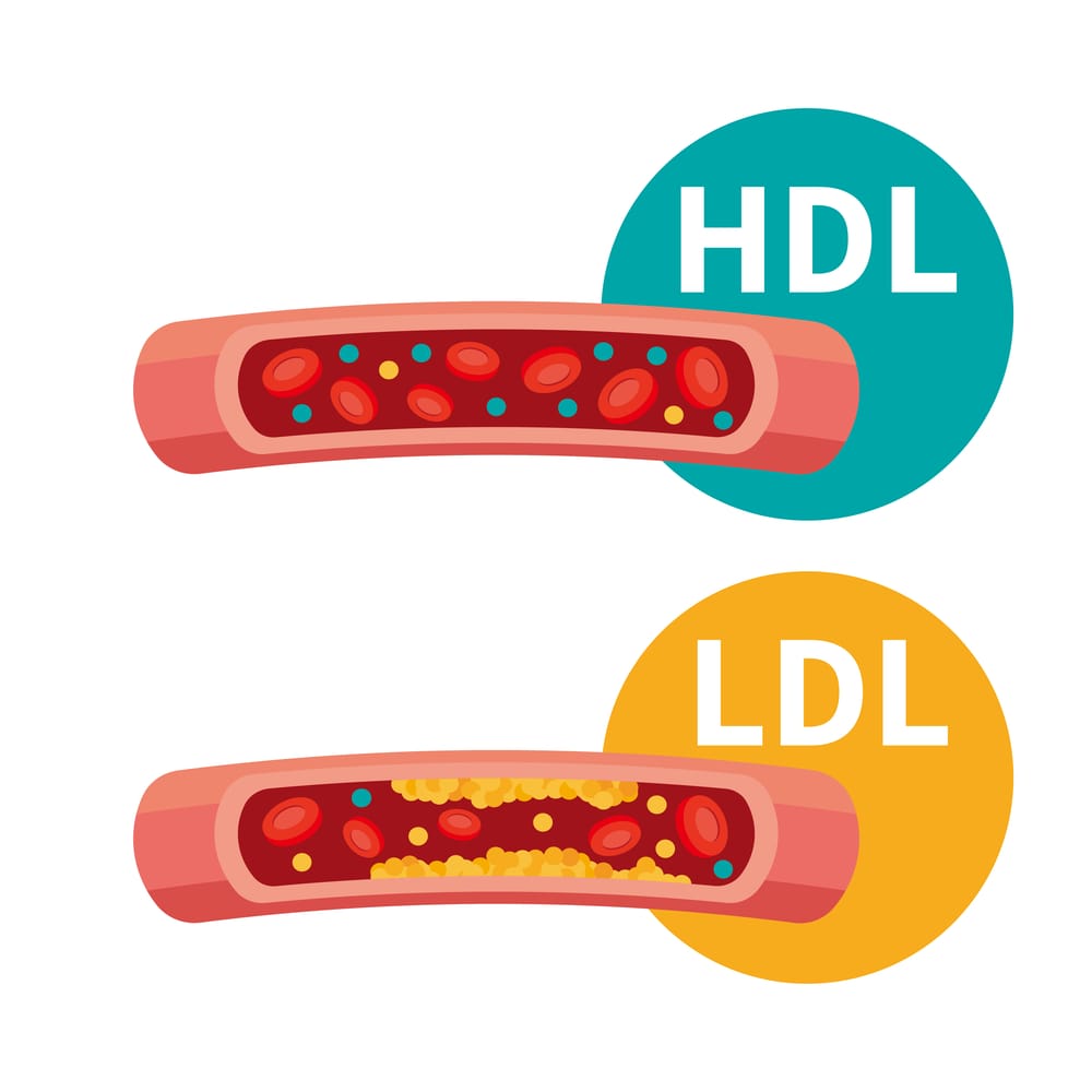 cholesterol HDL a cholesterol LDL